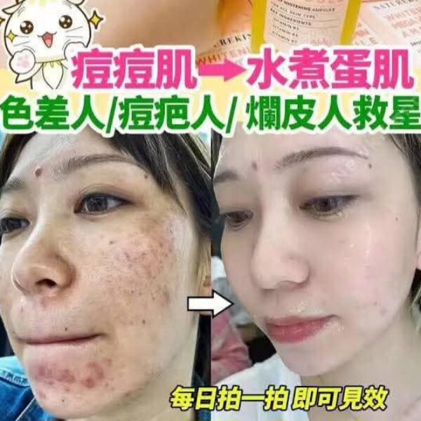 【特價】韓國Naturekind祛斑神仙水